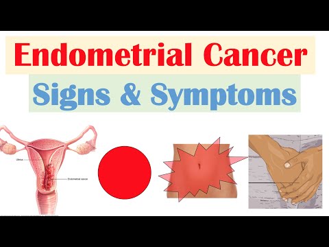 Endometrial Cancer Signs & Symptoms (& Why They Occur)