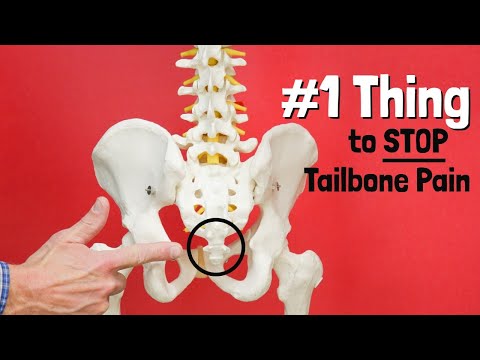 #1 Thing to STOP Tailbone or Sit Bone Pain + Giveaway