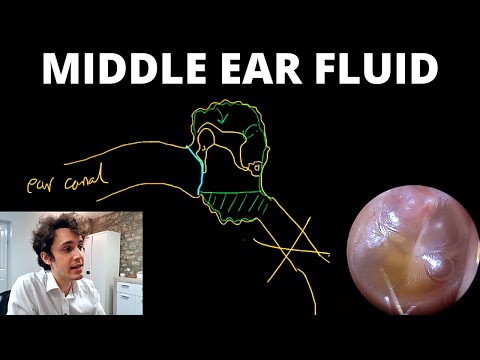Why Does Fluid Build Up Behind The Eardrum? (Otitis Media With Effusion)