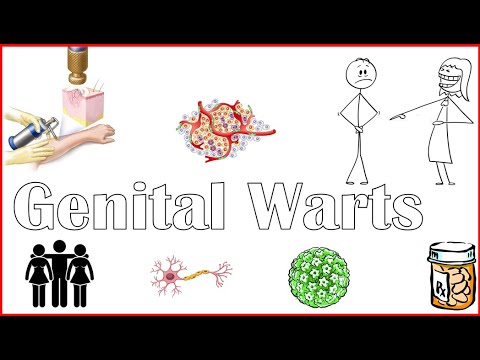 Genital Warts - Causes, Risk Factors, Signs & Symptoms, And Treatment