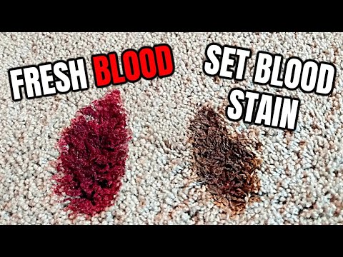 How to Remove BLOOD STAINS From Carpet